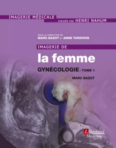 Imagerie de la femme : Gynécologie - Tome 1 - Anne TARDIVON, Marc Bazot - MEDECINE SCIENC