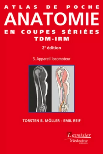 Atlas de poche Anatomie en coupes sériées TDM-IRM - Volume 3 : appareil locomoteur (2° Éd.) - Thieme Verlag KG Georg, Emil REIF, Torsten B. MÖLLER - MEDECINE SCIENC