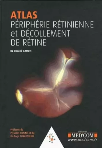 ATLAS.PERIPHERIE RETINIENNE. DECOLLEMENTS DE RETINE - Daniel Baron - MED COM