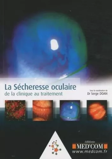 LA SECHERESSE OCCULAIRE - Serge Doan - MED COM