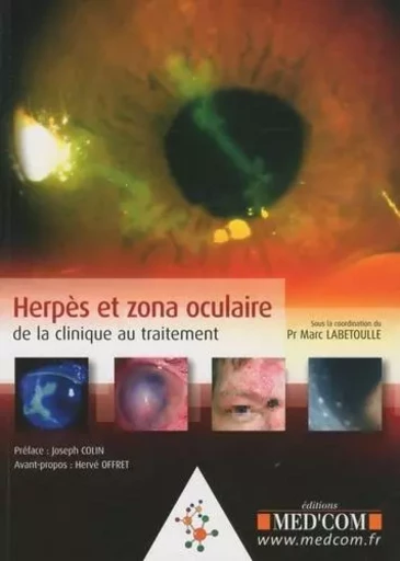 HERPES ET ZONA OCULAIRE - Marc Labetoulle - MED COM