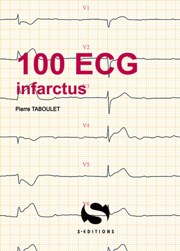 100 ECG autour de l'infarctus - Pierre Taboulet - S EDIT MILON