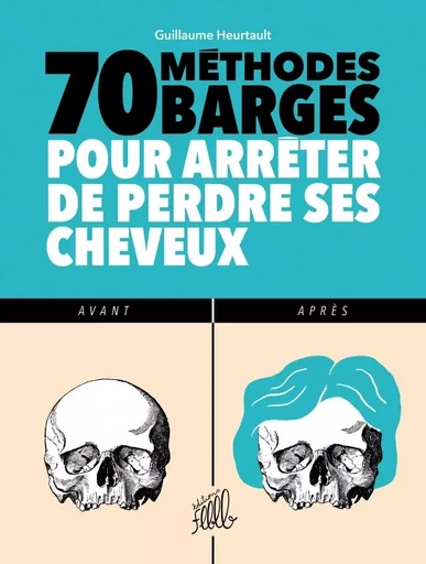 70 METHODES BARGES POUR ARRETER DE PERDRE SES CHEVEUX - Guillaume HEURTAULT - FLBLB