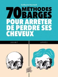 70 METHODES BARGES POUR ARRETER DE PERDRE SES CHEVEUX